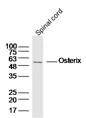 Mouse spinal cord lysates probed with Osterix Polyclonal Antibody, unconjugated (bs-1110R) at 1:300 overnight at 4\u00b0C followed by a conjugated secondary antibody for 60 minutes at 37\u00b0C.