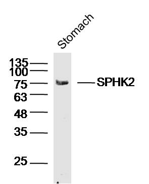 Mouse stomach lysates probed with SPHK2 Polyclonal Antibody, unconjugated (bs-2653R) at 1:300 overnight at 4\u00b0C followed by a conjugated secondary antibody for 60 minutes at 37\u00b0C.