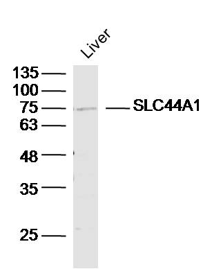 Mouse liver lysates probed with SLC44A1/CD92 Polyclonal Antibody, unconjugated (bs-3667R) at 1:300 overnight at 4°C followed by a conjugated secondary antibody for 60 minutes at 37°C.
