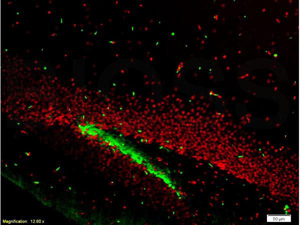 Tissue/cell: mouse brain tissue, 4% Paraformaldehyde-fixed and paraffin-embedded; Antigen retrieval: citrate buffer (0.01M, pH 6.0 ), Boiling bathing for 15min; Blocking buffer (normal goat serum,C-0005) at 37℃ for 20 min;_x000D_ _x000D_ Incubation: A Cy3 conjugated rabbit anti-NeuN polyclonal antibody (bs-1613R-Cy3, 1:200) and a FITC conjugated mouse anti-Brdu monoclonal antibody (bsm-0917M-FITC, 1:200), 40 minutes at 37°C.
