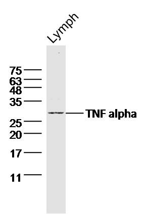 Mouse lymph node probed with TNF alpha Polyclonal Antibody (bs-10802R) at 1:300 overnight at 4°C followed by a conjugated secondary antibody for 60 minutes at 37°C.