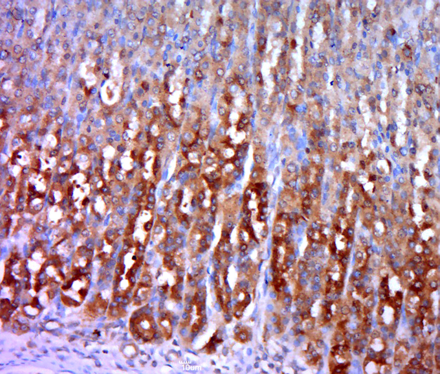 Paraformaldehyde-fixed, paraffin embedded rat stomach; Antigen retrieval by boiling in sodium citrate buffer (pH6.0) for 15min; Block endogenous peroxidase by 3% hydrogen peroxide for 20 minutes; Blocking buffer (normal goat serum) at 37°C for 30min; Antibody incubation with Hexokinase 1 Polyclonal Antibody, Unconjugated (bs-3992R) at 1:400 overnight at 4°C, followed by a conjugated secondary for 20 minutes and DAB staining.