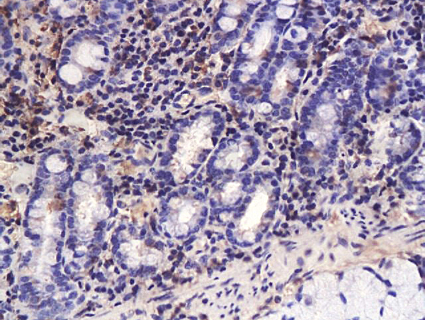 Formalin-fixed and paraffin embedded pig bile duct labeled with Anti-TGF-beta-3 Polyclonal Antibody, Unconjugated (bs-0099R) 1:200 followed by conjugation to the secondary antibody and DAB staining
