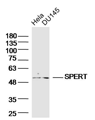 Lane 1: HeLa; Lane 2: DU145 cell lysates probed with SPERT Polyclonal Antibody (bs-17654R) at 1:300 overnight at 4°C followed by a conjugated secondary antibody for 60 minutes at 37°C.