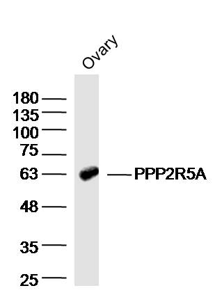 Mouse ovary lysates probed with PPP2R5A Polyclonal Antibody bs-19970R at 1:300 overnight at 4°C followed by a conjugated secondary antibody for 60 minutes at 37°C.