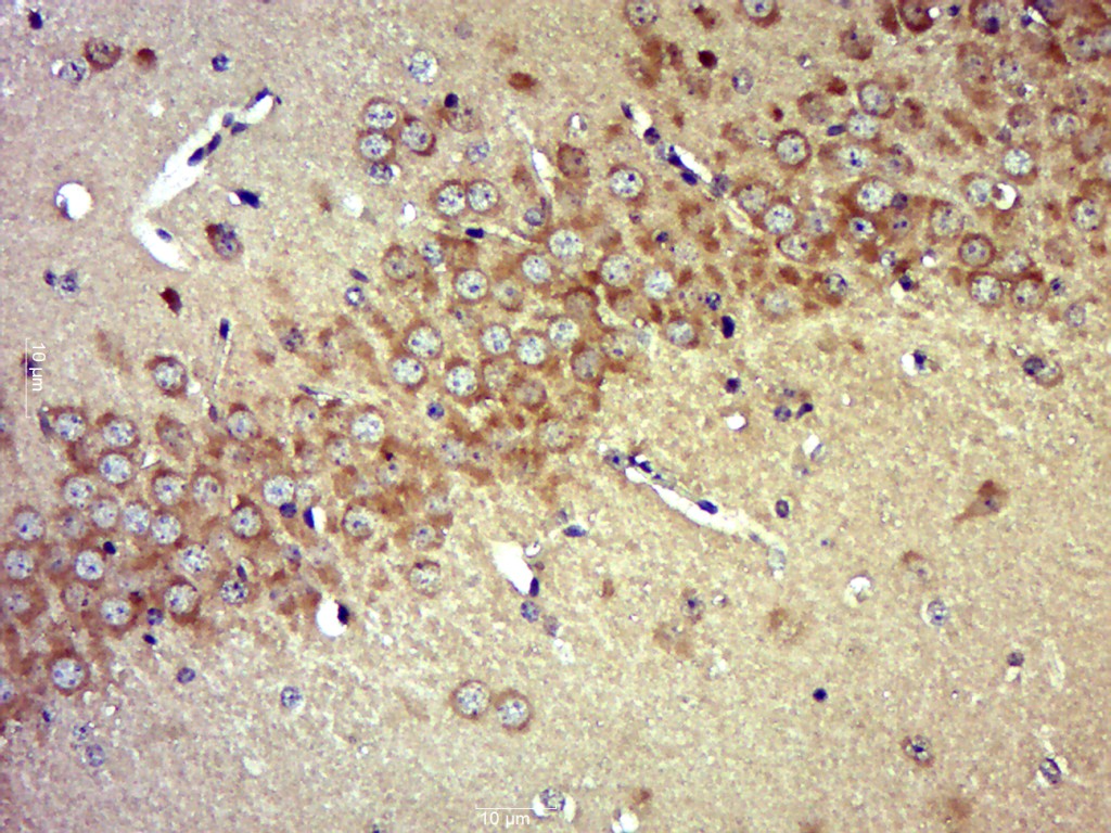 Paraformaldehyde-fixed, paraffin embedded Mouse brain; Antigen retrieval by boiling in sodium citrate buffer (pH6.0) for 15min; Block endogenous peroxidase by 3% hydrogen peroxide for 20 minutes; Blocking buffer (normal goat serum) at 37°C for 30min; Antibody incubation with HRG1 Polyclonal Antibody, Unconjugated (bs-1814R) at 1:400 overnight at 4°C, followed by a conjugated secondary antibody for 20 minutes and DAB staining