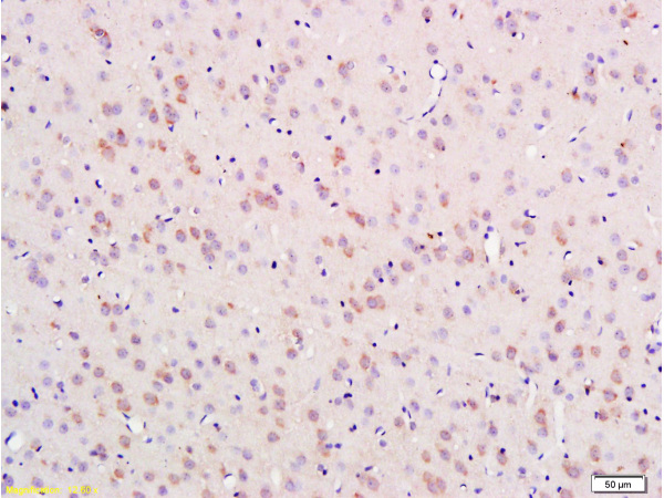 Formalin-fixed and paraffin embedded rat brain labeled with  Anti-Nestin Polyclonal Antibody (bs-0008R), Unconjugated 1:300 followed by conjugation to the secondary antibody and DAB staining
