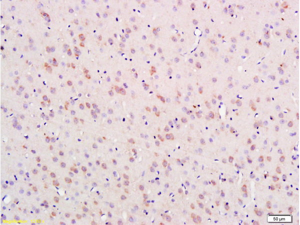 Formalin-fixed and paraffin embedded rat brain labeled with Anti-Nestin Polyclonal Antibody (bs-0008R), Unconjugated 1:300 followed by conjugation to the secondary antibody and DAB staining