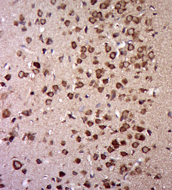 Paraformaldehyde-fixed, paraffin embedded rat brain; Antigen retrieval by boiling in sodium citrate buffer (pH6.0) for 15min; Block endogenous peroxidase by 3% hydrogen peroxide for 20 minutes; Blocking buffer (normal goat serum) at 37°C for 30min; Antibody incubation with E1 Ubiquitin Activating Enzyme Polyclonal Antibody, Unconjugated (bs-6835R) at 1:400 overnight at 4°C, followed by a conjugated secondary for 20 minutes and DAB staining.