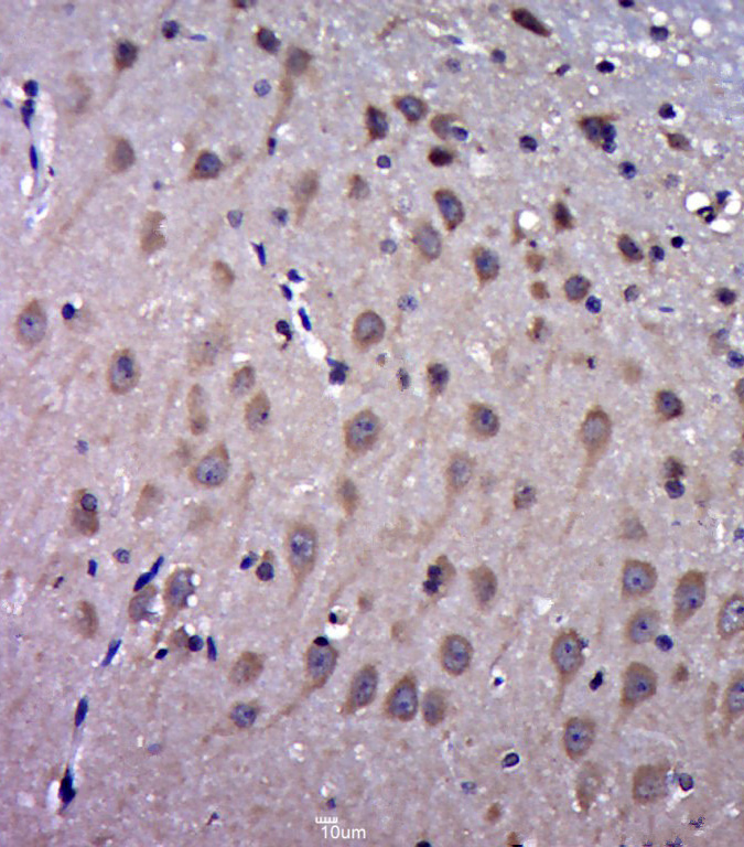 Paraformaldehyde-fixed, paraffin embedded rat brain; Antigen retrieval by boiling in sodium citrate buffer (pH6.0) for 15min; Block endogenous peroxidase by 3% hydrogen peroxide for 20 minutes; Blocking buffer (normal goat serum) at 37°C for 30min; Antibody incubation with FAM3C Polyclonal Antibody, Unconjugated (bs-7862R) at 1:400 overnight at 4°C, followed by a conjugated secondary for 20 minutes and DAB staining.