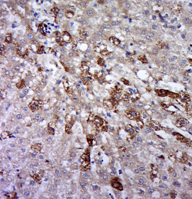 Paraformaldehyde-fixed, paraffin embedded rat liver; Antigen retrieval by boiling in sodium citrate buffer (pH6.0) for 15min; Block endogenous peroxidase by 3% hydrogen peroxide for 20 minutes; Blocking buffer (normal goat serum) at 37°C for 30min; Antibody incubation with phospho-gp130 (Ser782) Polyclonal Antibody, Unconjugated (bs-10122R) at 1:400 overnight at 4°C, followed by a conjugated secondary for 20 minutes and DAB staining.