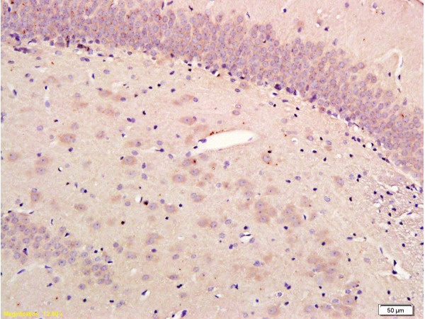 Formalin-fixed and paraffin embedded rat hippocampus labeled with Rabbit Anti-alpha-Synuclein (NT) Polyclonal Antibody, Unconjugated (bs-0009R) 1:300 followed by conjugation to the secondary antibody and DAB staining