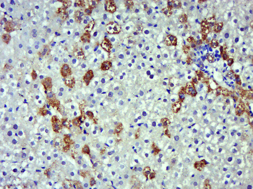 Paraformaldehyde-fixed, paraffin embedded rat liver; Antigen retrieval by boiling in sodium citrate buffer (pH6.0) for 15min; Block endogenous peroxidase by 3% hydrogen peroxide for 20 minutes; Blocking buffer (normal goat serum) at 37°C for 30min; Antibody incubation with NOS-2/iNOS Polyclonal Antibody, Unconjugated (bs-2072R) at 1:500 overnight at 4°C, followed by a conjugated secondary for 20 minutes and DAB staining.