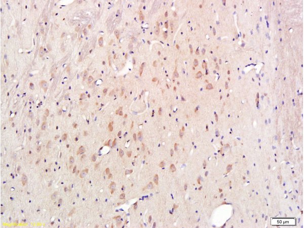 Formalin-fixed and paraffin embedded rat brain labeled with Rabbit Anti-Cytochrome C Polyclonal Antibody, Unconjugated (bs-0013R) 1:300 followed by conjugation to the secondary antibody and DAB staining