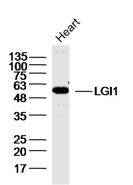 Mouse heart lysates probed with GI1 Polyclonal Antibody, unconjugated (bs-6719R) at 1:300 overnight at 4\u00b0C followed by a conjugated secondary antibody for 60 minutes at 37\u00b0C.