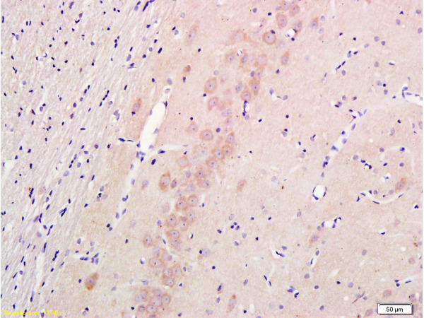 Formalin-fixed and paraffin embedded rat hippocampus labeled with Anti-Nestin Polyclonal Antibody (bs-0008R), Unconjugated 1:300 followed by conjugation to the secondary antibody and DAB staining