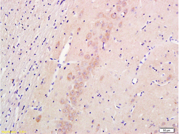 Nestin Polyclonal Antibody Bioss