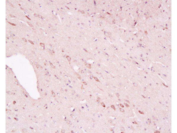 Formalin-fixed and paraffin embedded rat brain labeled with Rabbit Anti-Tyrosine Hydroxylase(Neuronal Marker)\/Tyk2\/TYH Polyclonal Antibody, Unconjugated  (bs-0016R) 1:200 followed by conjugation to the secondary antibody and DAB staining\\n