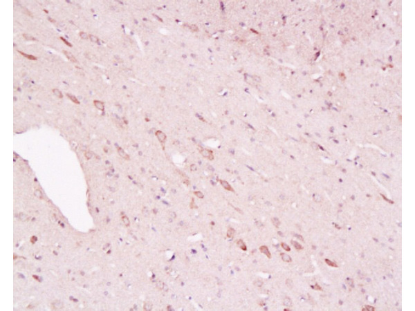 Formalin-fixed and paraffin embedded rat brain labeled with Rabbit Anti-Tyrosine Hydroxylase(Neuronal Marker)/Tyk2/TYH Polyclonal Antibody, Unconjugated  (bs-0016R) 1:200 followed by conjugation to the secondary antibody and DAB stainingn