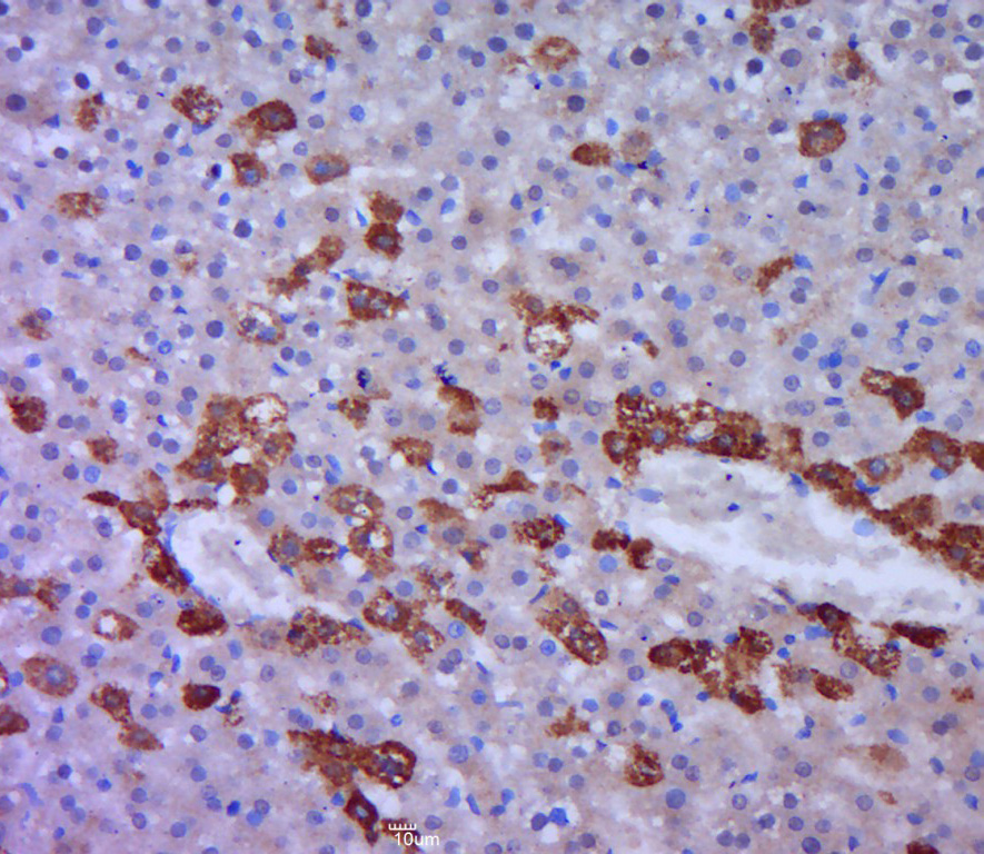 Paraformaldehyde-fixed, paraffin embedded rat liver; Antigen retrieval by boiling in sodium citrate buffer (pH6.0) for 15min; Block endogenous peroxidase by 3% hydrogen peroxide for 20 minutes; Blocking buffer (normal goat serum) at 37°C for 30min; Antibody incubation with FAT Polyclonal Antibody, Unconjugated (bs-4278R) at 1:400 overnight at 4°C, followed by a conjugated secondary for 20 minutes and DAB staining.