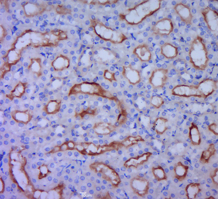 Paraformaldehyde-fixed, paraffin embedded rat kidney; Antigen retrieval by boiling in sodium citrate buffer (pH6.0) for 15min; Block endogenous peroxidase by 3% hydrogen peroxide for 20 minutes; Blocking buffer (normal goat serum) at 37°C for 30min; Antibody incubation with UGT1A9 Polyclonal Antibody, Unconjugated (bs-4224R) at 1:400 overnight at 4°C, followed by a conjugated secondary for 20 minutes and DAB staining.