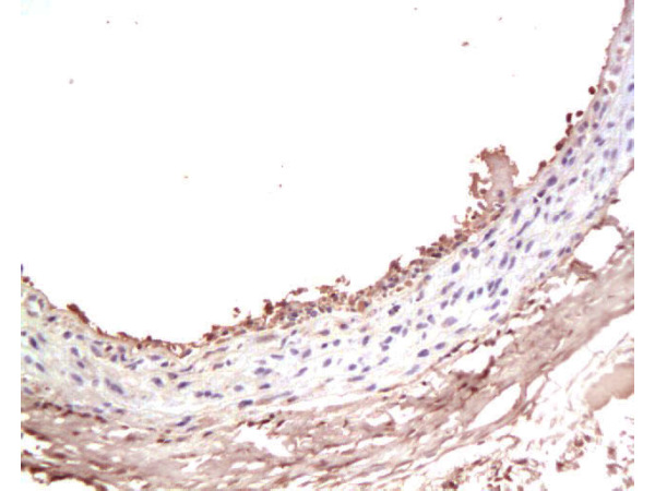 Formalin-fixed and paraffin-embedded rat Carotid artery labeled with Rabbit Anti-IGF-I Polyclonal Antibody (bs-0014R), Unconjugated at 1:200 followed by conjugation to the secondary antibody and DAB staining