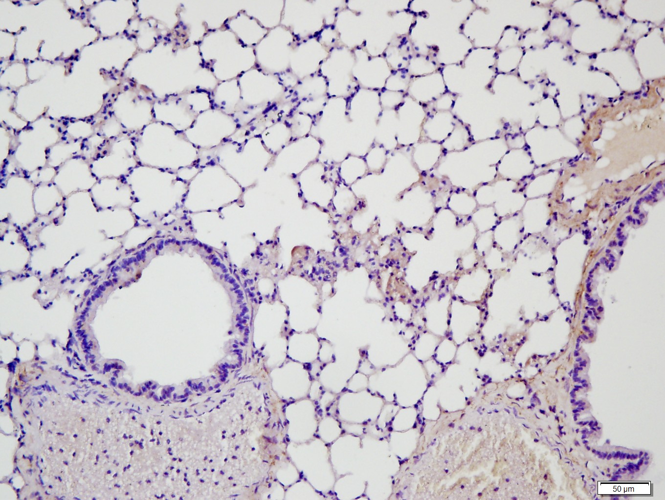 Paraformaldehyde-fixed, paraffin embedded Mouse lung; Antigen retrieval by boiling in sodium citrate buffer (pH6.0) for 15min; Block endogenous peroxidase by 3% hydrogen peroxide for 20 minutes; Blocking buffer (normal goat serum) at 37°C for 30min; Antibody incubation with MMP2 Polyclonal Antibody, Unconjugated (bs-0412R) at 1:400 overnight at 4°C, followed by a conjugated secondary antibody for 20 minutes and DAB staining.