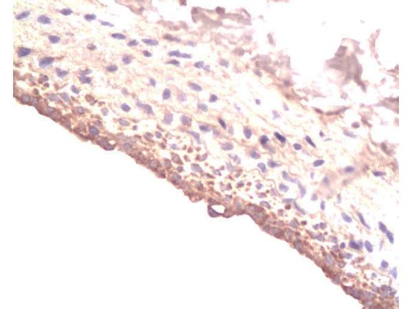 Formalin-fixed and paraffin-embedded rat Carotid artery labeled with Rabbit Anti-IGF-I Polyclonal Antibody (bs-0014R), Unconjugated at 1:200 followed by conjugation to the secondary antibody and DAB staining