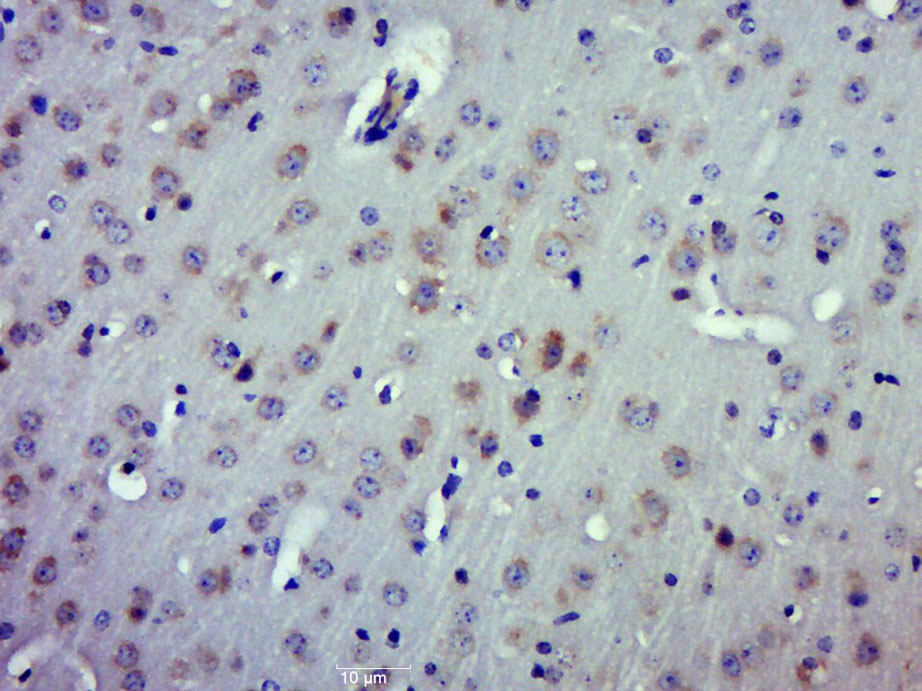 Paraformaldehyde-fixed, paraffin embedded mouse brai; Antigen retrieval by boiling in sodium citrate buffer (pH6.0) for 15min; Block endogenous peroxidase by 3% hydrogen peroxide for 20 minutes; Blocking buffer (normal goat serum) at 37°C for 30min; Antibody incubation with CRMP2/TOAD64 Polyclonal Antibody (bs-1790R) at 1:400 overnight at 4°C, followed by a conjugated secondary for 20 minutes and DAB staining.