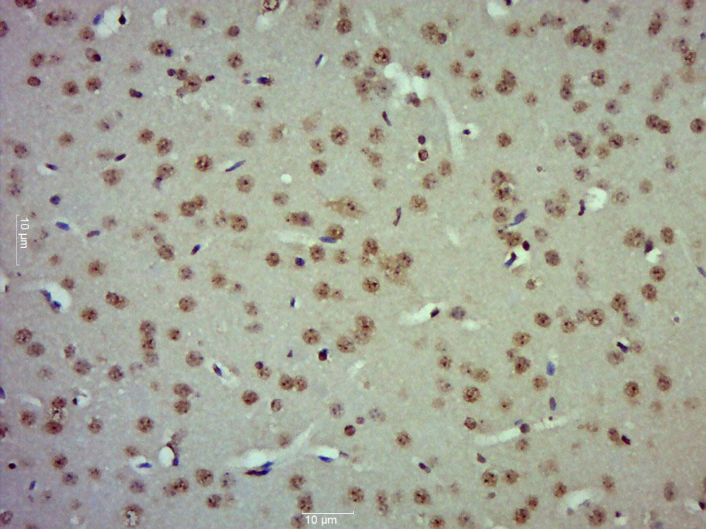 Paraformaldehyde-fixed, paraffin embedded mouse brain; Antigen retrieval by boiling in sodium citrate buffer (pH6.0) for 15min; Block endogenous peroxidase by 3% hydrogen peroxide for 20 minutes; Blocking buffer (normal goat serum) at 37°C for 30min; Antibody incubation with ZBTB2 Polyclonal Antibody (bs-7707R) at 1:400 overnight at 4°C, followed by a conjugated secondary for 20 minutes and DAB staining.