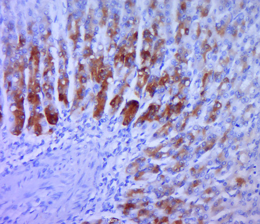 Paraformaldehyde-fixed, paraffin embedded rat stomach; Antigen retrieval by boiling in sodium citrate buffer (pH6.0) for 15min; Block endogenous peroxidase by 3% hydrogen peroxide for 20 minutes; Blocking buffer (normal goat serum) at 37°C for 30min; Antibody incubation with TGF alpha Polyclonal Antibody, Unconjugated (bs-0066R) at 1:400 overnight at 4°C, followed by a conjugated secondary for 20 minutes and DAB staining.