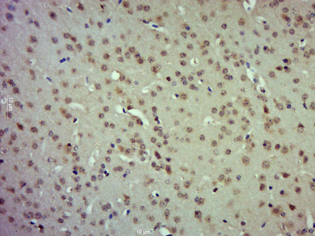 Paraformaldehyde-fixed, paraffin embedded mouse brain; Antigen retrieval by boiling in sodium citrate buffer (pH6.0) for 15min; Block endogenous peroxidase by 3% hydrogen peroxide for 20 minutes; Blocking buffer (normal goat serum) at 37°C for 30min; Antibody incubation with Etv5 Polyclonal Antibody (bs-8592R) at 1:400 overnight at 4°C, followed by a conjugated secondary for 20 minutes and DAB staining. Paraformaldehyde-fixed, paraffin embedded mouse brain; Antigen retrieval by boiling in sodium citrate buffer (pH6.0) for 15min; Block endogenous peroxidase by 3% hydrogen peroxide for 20 minutes; Blocking buffer (normal goat serum) at 37°C for 30min; Antibody incubation with Etv5 Polyclonal Antibody (bs-8592R) at 1:400 overnight at 4°C, followed by a conjugated secondary for 20 minutes and DAB staining.