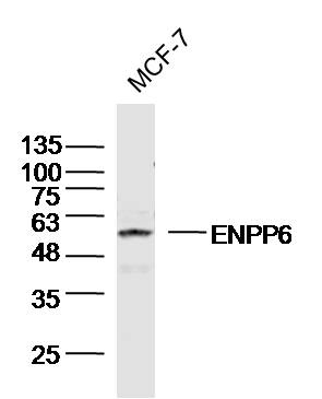 MCF-7 Cell lysates probed with ENPP6 Polyclonal Antibody, unconjugated (bs-13076R) at 1:300 overnight at 4°C followed by a conjugated secondary antibody for 60 minutes at 37°C.