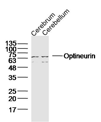Lane 1: Mouse Cerebrum lysates; Lane 2: Mouse cerebellum; probed with Optineurin Polyclonal Antibody, unconjugated (bs-13658R) at 1:300 overnight at 4°C followed by a conjugated secondary antibody for 60 minutes at 37°C.