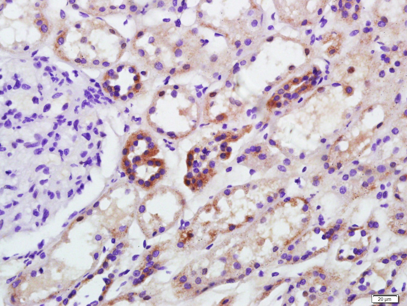 Paraformaldehyde-fixed, paraffin embedded human kidney; Antigen retrieval by boiling in sodium citrate buffer (pH6.0) for 15min; Block endogenous peroxidase by 3% hydrogen peroxide for 20 minutes; Blocking buffer (normal goat serum) at 37°C for 30min; Antibody incubation with GAPDH Polyclonal Antibody, Unconjugated (bs-10900R) at 1:2000 overnight at 4°C, followed by a conjugated secondary for 20 minutes and DAB staining.
