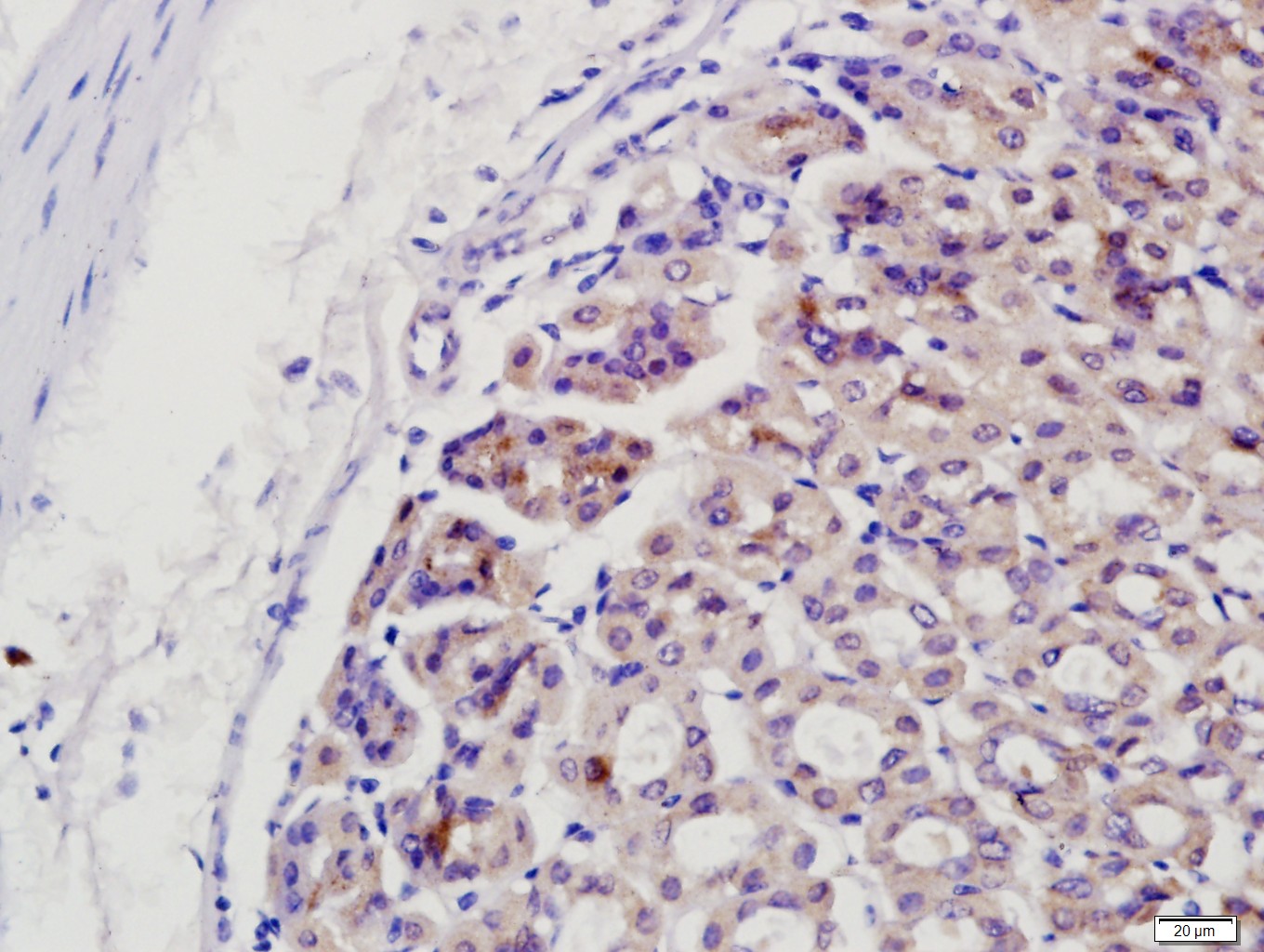 Paraformaldehyde-fixed, paraffin embedded Mouse stomach; Antigen retrieval by boiling in sodium citrate buffer (pH6.0) for 15min; Block endogenous peroxidase by 3% hydrogen peroxide for 20 minutes; Blocking buffer (normal goat serum) at 37°C for 30min; Antibody incubation with CIAPIN1 Polyclonal Antibody, Unconjugated (bs-5764R) at 1:400 overnight at 4°C, followed by a conjugated secondary antibody for 20 minutes and DAB staining. Paraformaldehyde-fixed, paraffin embedded Mouse stomach; Antigen retrieval by boiling in sodium citrate buffer (pH6.0) for 15min; Block endogenous peroxidase by 3% hydrogen peroxide for 20 minutes; Blocking buffer (normal goat serum) at 37°C for 30min; Antibody incubation with CIAPIN1 Polyclonal Antibody, Unconjugated (bs-5764R) at 1:400 overnight at 4°C, followed by a conjugated secondary antibody for 20 minutes and DAB staining.