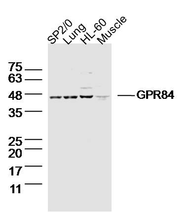 Lane 1: SP2/0 Cell lysates; Lane 2: Mouse lung lysates; Lane 3: HL-60 Cell lysates; Lane 4: Mouse muscle lysates; probed with GPR84 Polyclonal Antibody, unconjugated (bs-13507R) at 1:300 overnight at 4°C followed by a conjugated secondary antibody for 60 minutes at 37°C. Lane 1: SP2/0 Cell lysates; Lane 2: Mouse lung lysates; Lane 3: HL-60 Cell lysates; Lane 4: Mouse muscle lysates; probed with GPR84 Polyclonal Antibody, unconjugated (bs-13507R) at 1:300 overnight at 4°C followed by a conjugated secondary antibody for 60 minutes at 37°C.