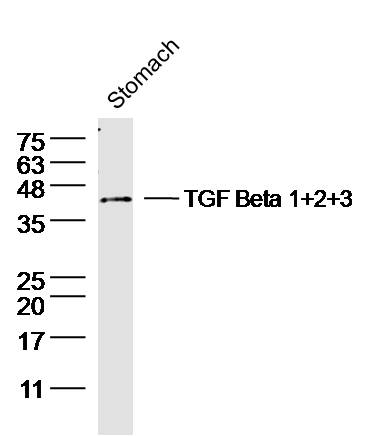 Mouse Stomach lysates probed with TGF Beta 1+2+3  Polyclonal Antibody, unconjugated (bs-4538R) at 1:300 overnight at 4\u00b0C followed by a conjugated secondary antibody for 60 minutes at 37\u00b0C.