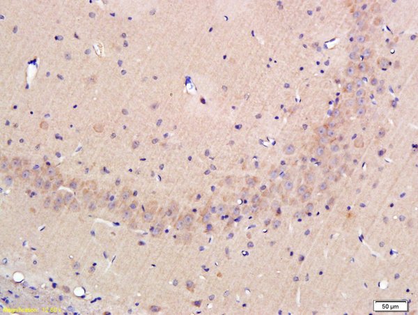 Formalin-fixed and paraffin-embedded rat hippocampus labeled with Rabbit Anti-OPN Polyclonal Antibody, Unconjugated (bs-0026R) at 1:300 followed by conjugation to the secondary antibody