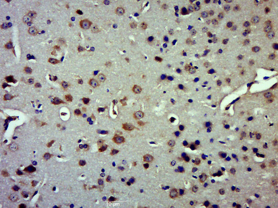 Paraformaldehyde-fixed, paraffin embedded mouse brain; Antigen retrieval by boiling in sodium citrate buffer (pH6.0) for 15min; Block endogenous peroxidase by 3% hydrogen peroxide for 20 minutes; Blocking buffer (normal goat serum) at 37°C for 30min; Antibody incubation with IDE Polyclonal Antibody, Unconjugated (bs-0018R) at 1:500 overnight at 4°C, followed by a conjugated secondary for 20 minutes and DAB staining.