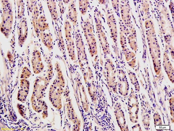 Formalin-fixed and paraffin-embedded human stomach tissue labeled with Rabbit Anti-OPN Polyclonal Antibody, Unconjugated (bs-0019R) at 1:200 followed by conjugation to the secondary antibody and DAB staining