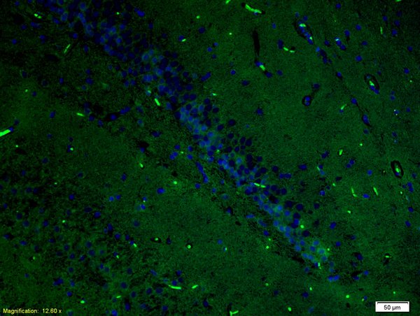 Formalin-fixed and paraffin-embedded rat brain labeled with Anti-ERK2/MAPK1 Polyclonal Antibody, Unconjugated(bs-0022R) 1:200, overnight at 4°C, The secondary antibody was Goat Anti-Rabbit IgG, FITC conjugated(bs-0295G-FITC)used at 1:200 dilution for 40 minutes at 37°C.