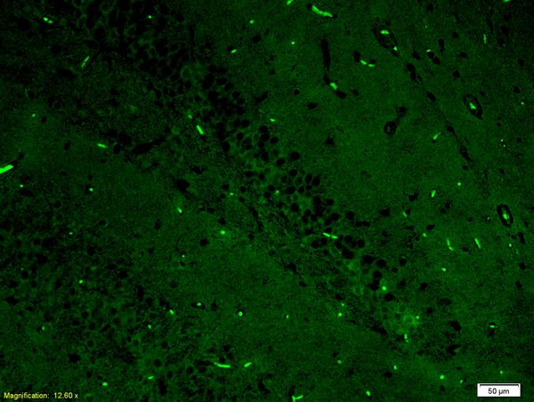 Formalin-fixed and paraffin-embedded rat brain labeled with Anti-ERK2\/MAPK1 Polyclonal Antibody, Unconjugated(bs-0022R) 1:200, overnight at 4\u00b0C, The secondary antibody was Goat Anti-Rabbit IgG, FITC conjugated(bs-0295G-FITC)used at 1:200 dilution for 40 minutes at 37\u00b0C.
