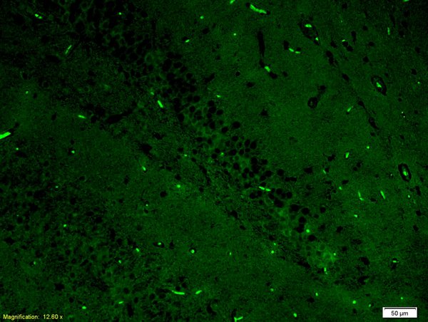 Formalin-fixed and paraffin-embedded rat brain labeled with Anti-ERK2/MAPK1 Polyclonal Antibody, Unconjugated(bs-0022R) 1:200, overnight at 4°C, The secondary antibody was Goat Anti-Rabbit IgG, FITC conjugated(bs-0295G-FITC)used at 1:200 dilution for 40 minutes at 37°C.