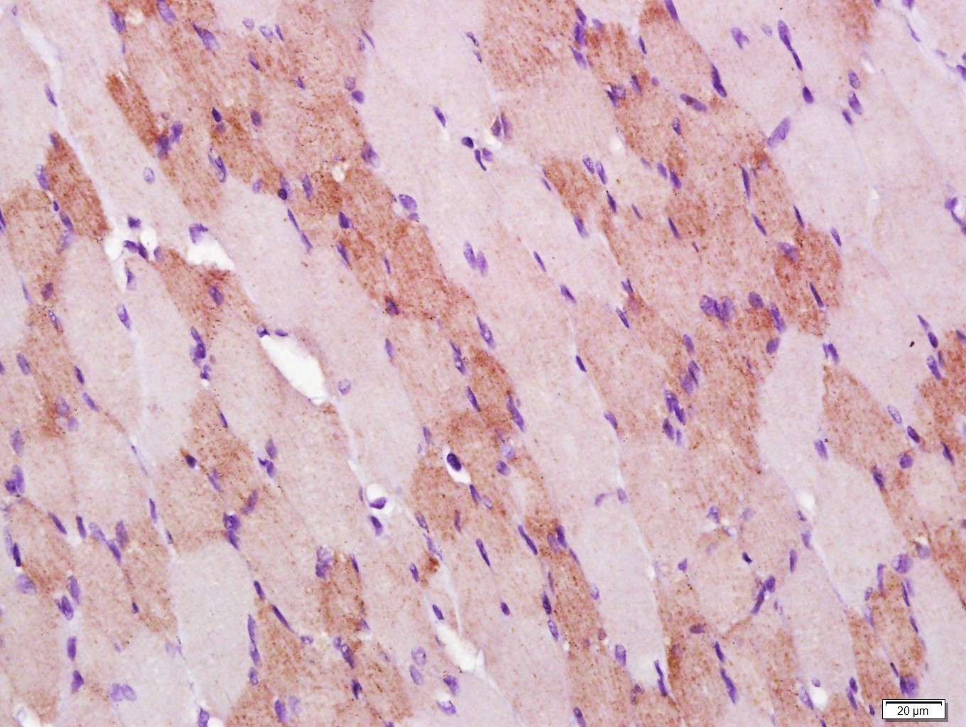 Paraformaldehyde-fixed, paraffin embedded rat skeletal muscle; Antigen retrieval by boiling in sodium citrate buffer (pH6.0) for 15min; Block endogenous peroxidase by 3% hydrogen peroxide for 20 minutes; Blocking buffer (normal goat serum) at 37°C for 30min; Antibody incubation with COX4 (8D8) Monoclonal Antibody, Unconjugated (bsm-33037M) at 1:2000 overnight at 4°C, followed by a conjugated secondary for 20 minutes and DAB staining.