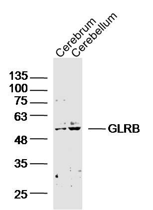 Lane 1: Mouse Cerebrum; Lane 2: Mouse Cerebellum lysates probed with GLRB Polyclonal Antibody, Unconjugated (bs-20450R) at 1:300 overnight at 4˚C. Followed by a conjugated secondary antibody at 1:20000 for 90 min at 37˚C.