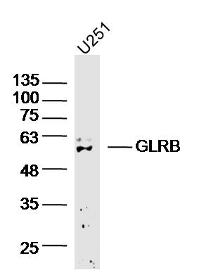 U251 cell lysates probed with GLRB Polyclonal Antibody, Unconjugated (bs-20450R) at 1:300 overnight at 4˚C. Followed by a conjugated secondary antibody at 1:20000 for 90 min at 37˚C