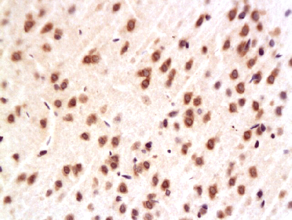Formalin-fixed and paraffin embedded rat hippocampus labeled with Anti-ERK2\/MAPK1 Polyclonal Antibody, Unconjugated (bs-0022R) at 1:200, followed by conjugation to the secondary antibody and DAB staining