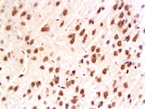 Formalin-fixed and paraffin embedded rat hippocampus labeled with Anti-ERK2/MAPK1 Polyclonal Antibody, Unconjugated (bs-0022R) at 1:200, followed by conjugation to the secondary antibody and DAB staining