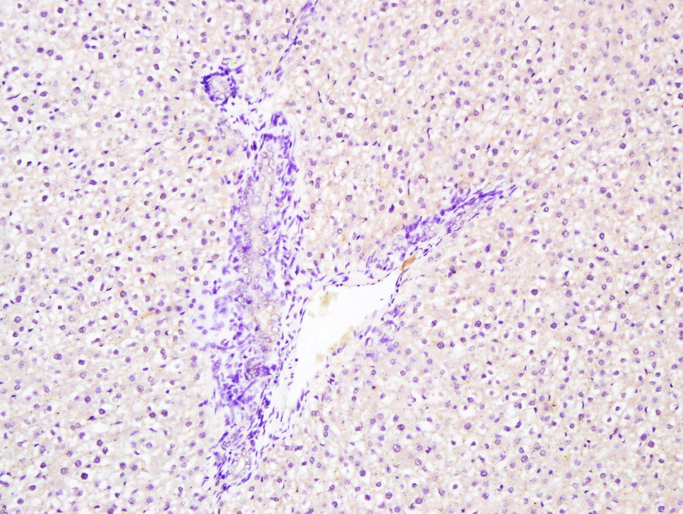 Paraformaldehyde-fixed, paraffin embedded rat liver; Antigen retrieval by boiling in sodium citrate buffer (pH6.0) for 15min; Block endogenous peroxidase by 3% hydrogen peroxide for 20 minutes; Blocking buffer (normal goat serum) at 37°C for 30min; Antibody incubation with Phospho1 Polyclonal Antibody, Unconjugated (bs-12562R) at 1:400 overnight at 4°C, followed.